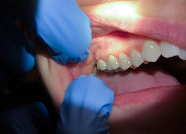 Best Dentist Open Late Near Me  in Crittenden, KY